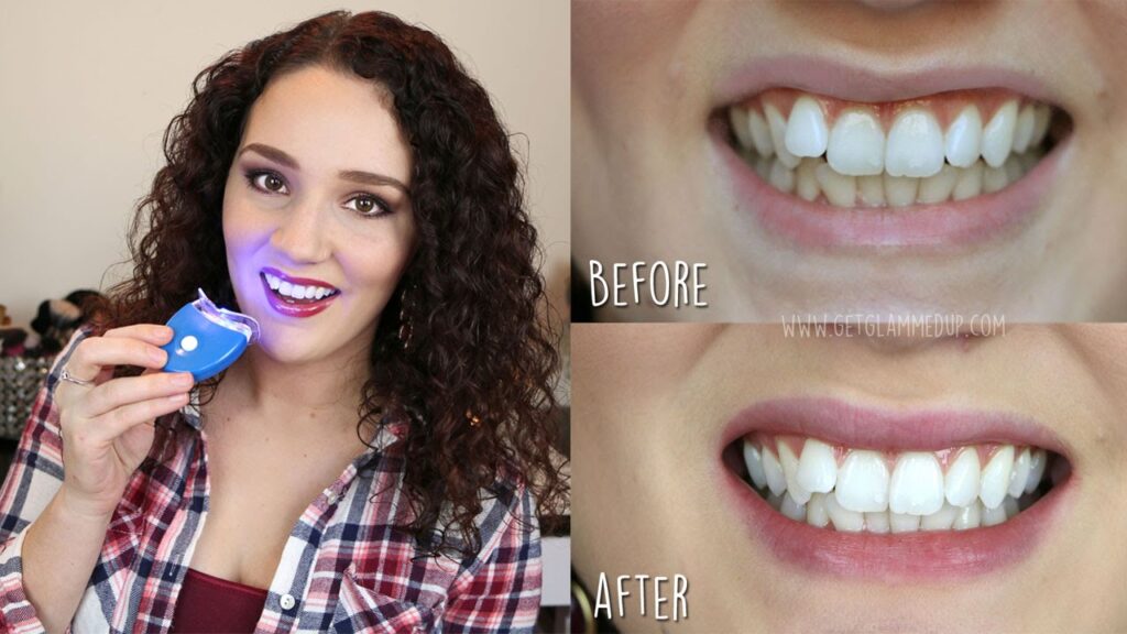 Teeth Whitening Product