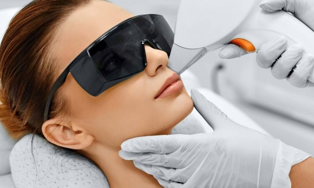 laser Hair Removal